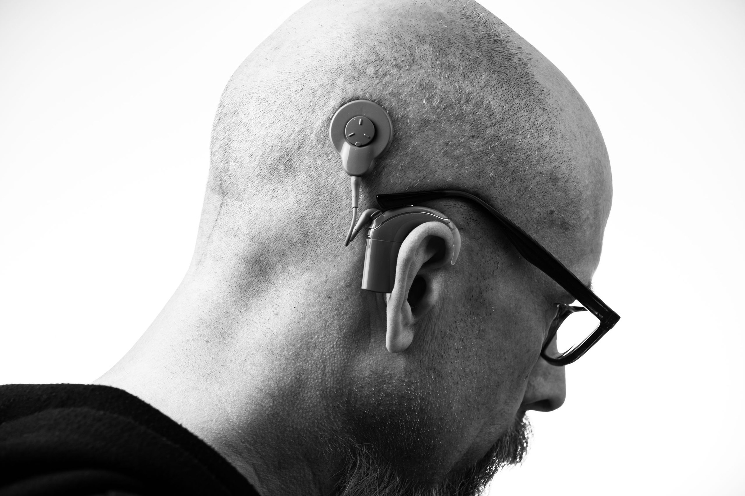 Aide auditive amplificateur Audioclear discret : avis, limites et alternatives remboursées