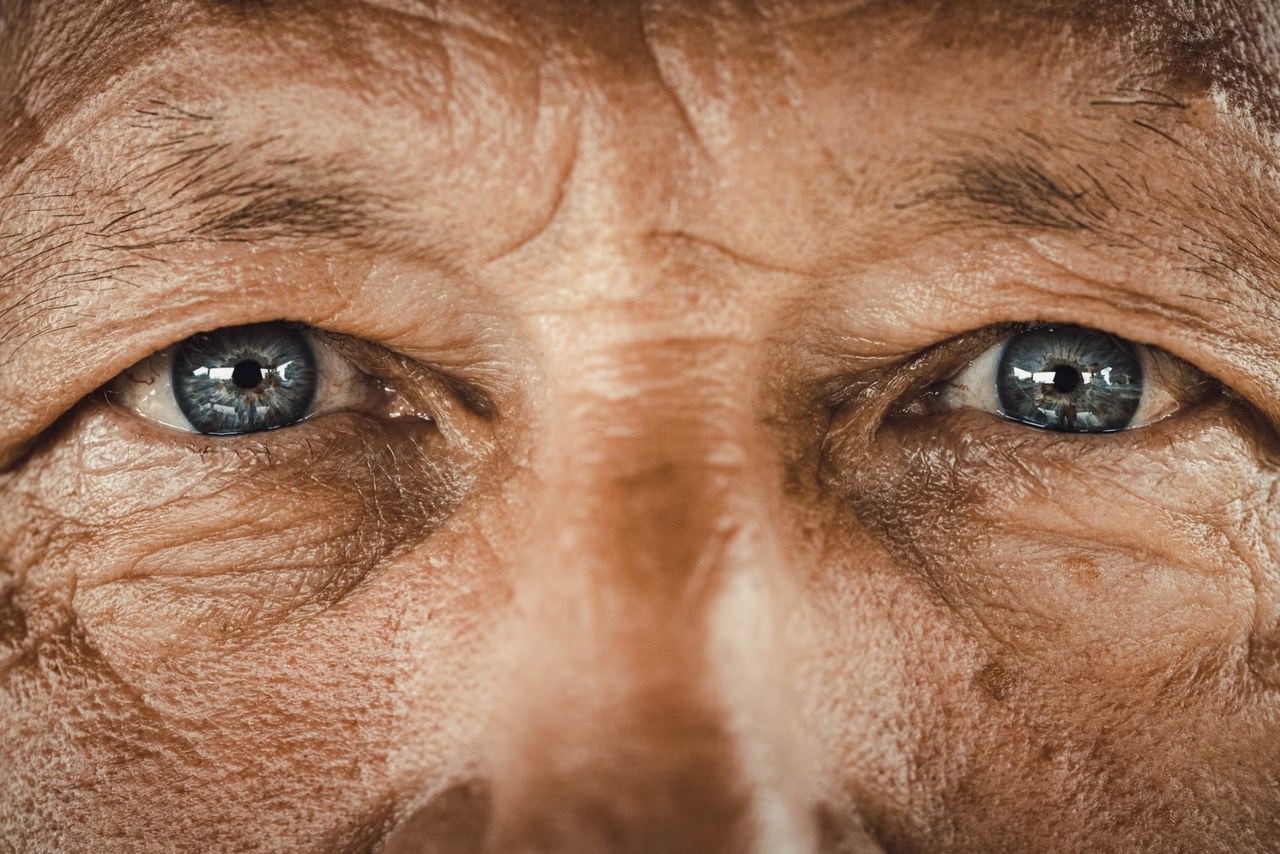 Manque de fer : symptômes dans les yeux, signes et examens
